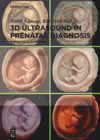 book: 3D Ultrasound in Prenatal Diagnosis